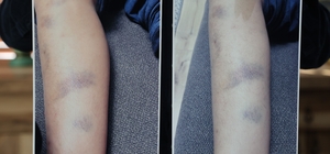 Diyarbakır'da özel okulda 8 yaşındaki çocuğun darbedildiği iddiası