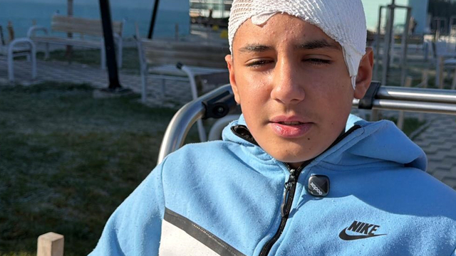 Şakalaştığı okul arkadaşı, taşla Hasan Berat'ı hastanelik etti