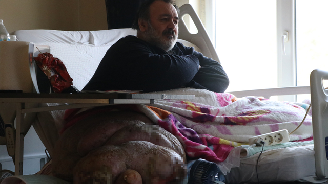 5 yıldır evden çıkamayan 300 kiloya ulaşan fil hastasının hayali; eşiyle kol kola caddede gezmek