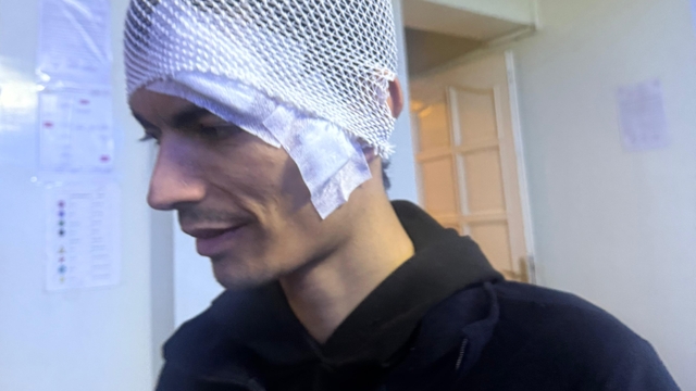 Gaziantep'te engelli bakım merkezinde darp skandalı: Merkezde kalan gencin kafasına 6 dikiş atıldı
Darp edilen engelli gencin ailesi, sorumluların cezalandırılmasını istedi
Engelli gencin vücudundaki darp izleri dikkat çekti