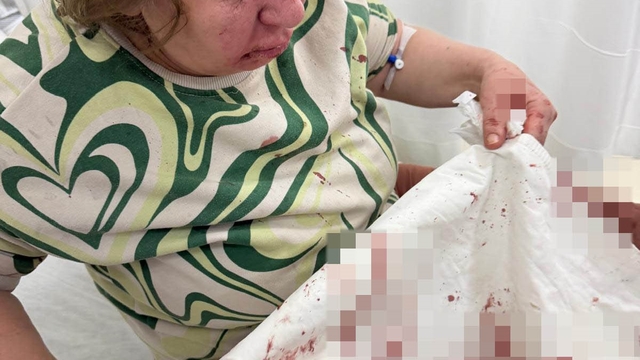 Komşusunu darp eden sivil memur hakkında soruşturma açıldı
Gürültüden rahatsız olduğu için komşusunu uyaran kadın darp edildi