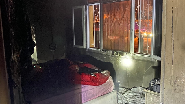 Adana'da evinde çıkan yangında yaralandı