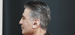 Bitlis'te ilk defa yüz germe ameliyatı başarıyla yapıldı