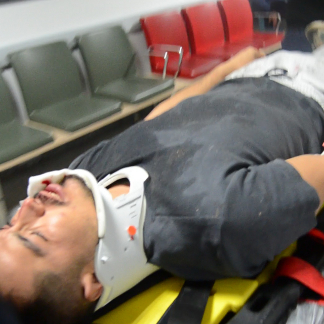 Anahtarı unuttuğu eve balkondan girmek isterken düşüp, yaralandı