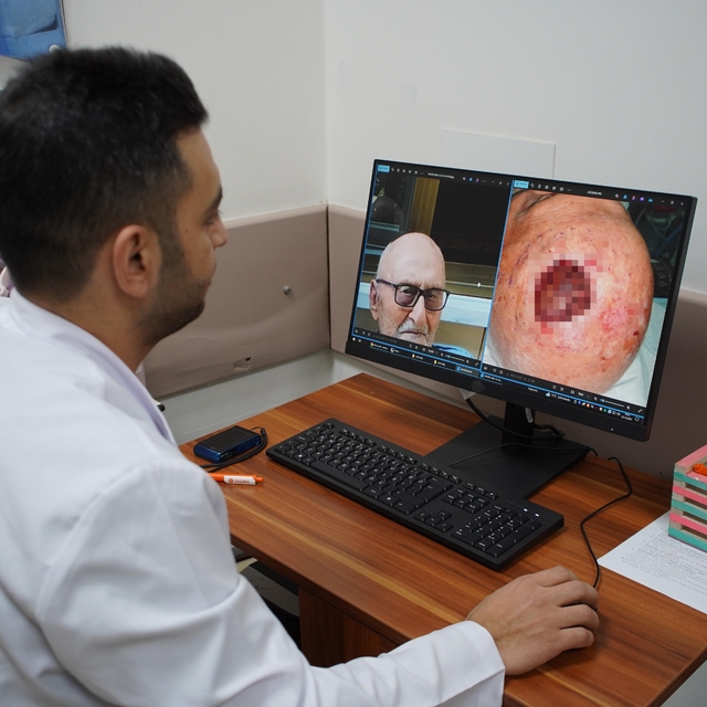 Dünyada 3'üncü kez rastlandı: Saçlı derideki nadir tümör Sakarya'da tedavi...