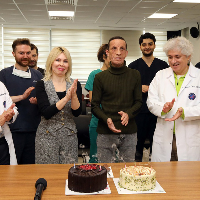 İlk yüz nakilli Uğur Acar, hayata 14 yıldır başka bir yüzle bakıyor