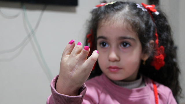 10 ameliyat geçiren yapışık parmak Elif Lina'nın ailesinden çağrı