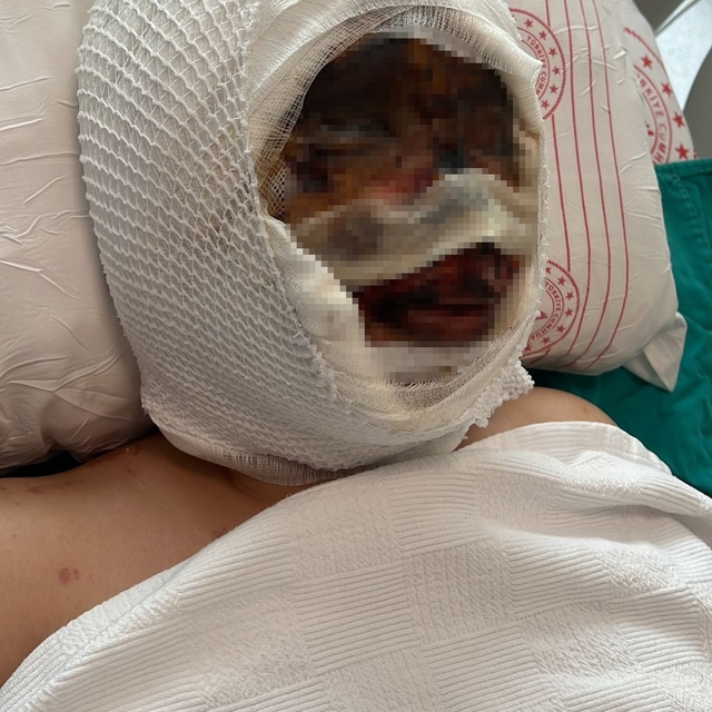 Eski eşi tarafından vahşete uğrayan kadın o anları anlattı, acılı baba sert...