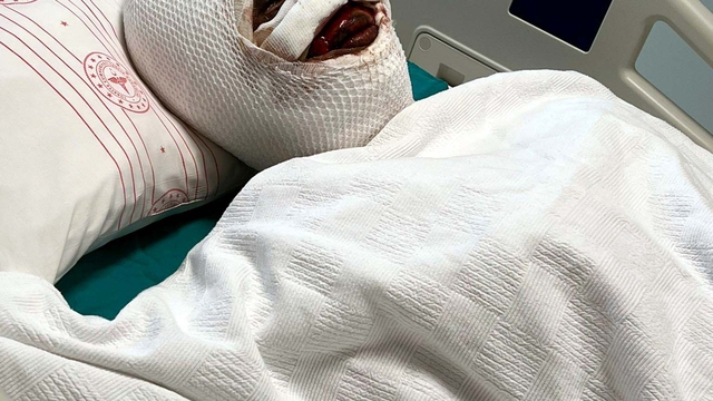 Boşanma aşamasındaki eşini koli bandı ile bağlayıp, başından aşağı kezzap döktü (2)