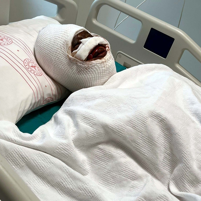 Boşanma aşamasındaki eşini koli bandı ile bağlayıp, başından aşağı kezzap d...