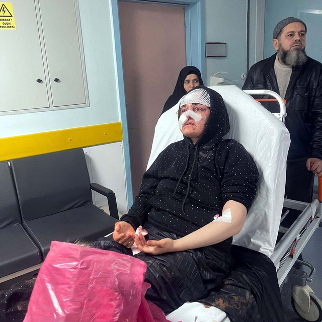 Boşanma aşamasındaki eşini kaldırım taşıyla dövdü