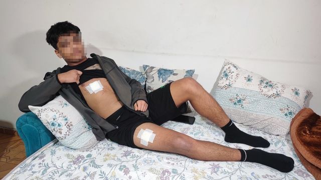 Akran zorbalığı az kalsın öldürüyordu: Önce dövüldü sonra bıçaklandı