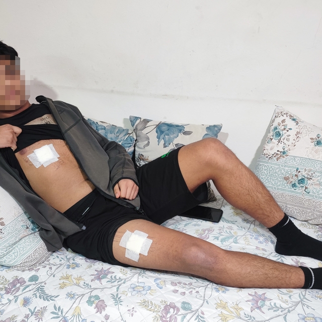 Akran zorbalığı az kalsın öldürüyordu: Önce dövüldü sonra bıçaklandı