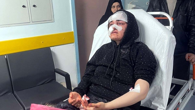 Boşanma aşamasındaki eşini kaldırım taşıyla ağır yaralayan şüpheli tutuklandı