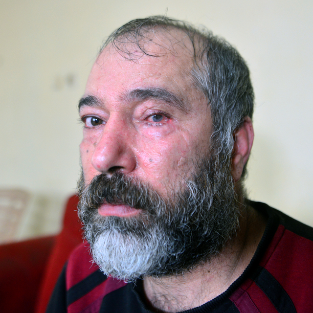 Durakta 'küfür' tartışmasında bardakla vurulan gözünü kaybetti, şüphelinin...