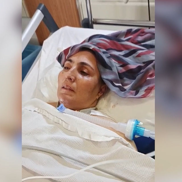 Eşinin dövüp, olayı kaza gibi göstermeye çalıştığı kadın, 54 gündür yoğun b...