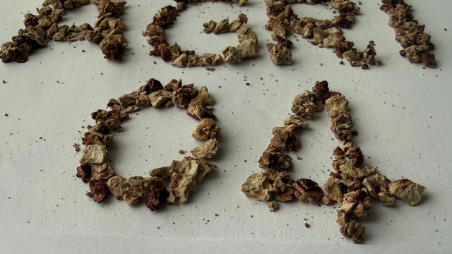 Ağrı'da zorlu taş cerrahisi başarıyla gerçekleştirildi