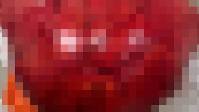 Görenler kilo aldı sandı, karnından 30 santim uzunluğunda 10,5 kiloluk kitle çıktı