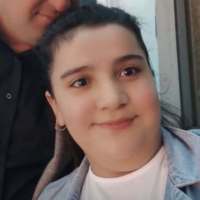 Sobayı tutuşturmaya çalışırken yüzü yanan Ceylin kurtarılamadı