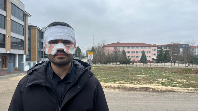 Rehber öğretmenin yüzüne sıcak çay fırlattığı fizik öğretmeni feci şekilde yandı
Fizik öğretmeni Serkan Keskinbaş: "Sıcak çayı kasıtlı olarak yüzüme fırlattı, beni haşladı"
"Ağza alınmayacak ağır küfür etti"