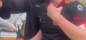 Maç sonu saha karıştı: 3 futbolcu yaralandı
Yaralan futbolcu hastaneye kald...