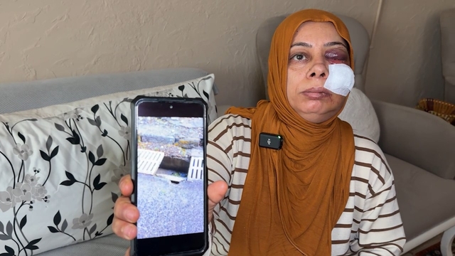 Elektrikli bisikleti ile kapağı kırık rögara düştü; yüzüne 14 dikiş atıldı