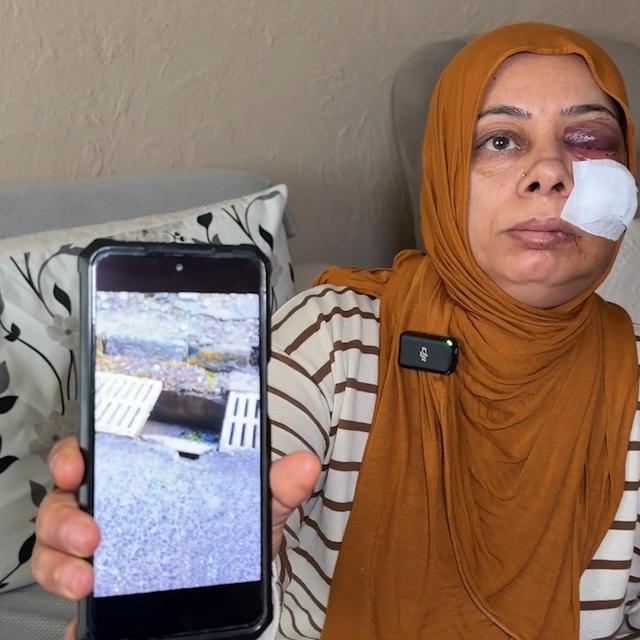 Elektrikli bisikleti ile kapağı kırık rögara düştü; yüzüne 14 dikiş atıldı