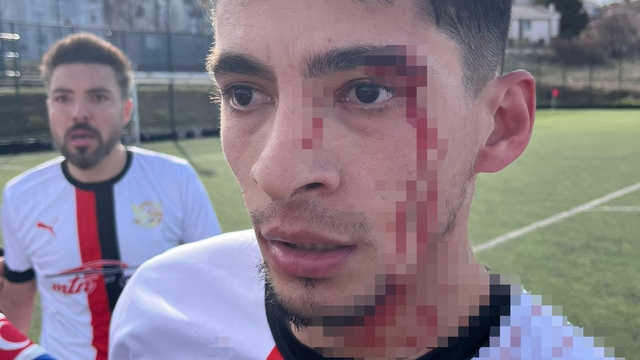 Maç sonrası saha içi savaş alanına döndü, 3 futbolcu hastanelik oldu
Gülümbespor Başkanı Ergün Akbal:
"Yaşanan bu olayla ilgili tüm adli şikayetler yapılmış olup, takipçisi olunmaya devam edilecektir"