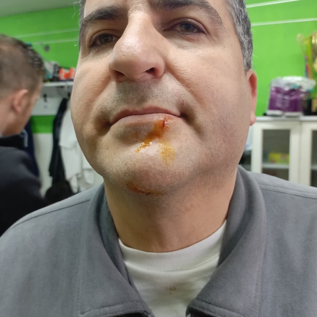 Zonguldak'ta 3. Lig maçı sonrası gerginlik: 2 gazeteci darbedildi, 2 polis...