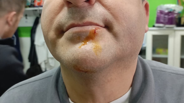 Zonguldak'ta 3. Lig maçı sonrası gerginlik: 2 gazeteci darbedildi, 2 polis yaralandı