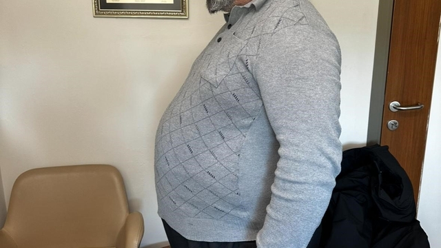 Özel Sular Akademi Hastanesi'nde özel diyetle bir yılda 52 kilo verdi