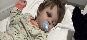 'Çocuk annesinin kucağından düştü, babası kendi burnundaki kanı üzerine akı...