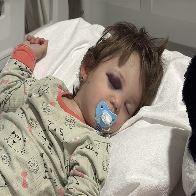 'Çocuk annesinin kucağından düştü, babası kendi burnundaki kanı üzerine akı...