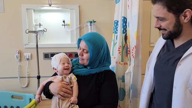 5 aylık Ömer'in erken kaynayan kafatası 3 saatlik ameliyatla düzeltildi