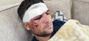 Döner ustası motosiklet sürücüsü: "Kaza sonrası kaçıp gittiler"
Sürücü, çar...