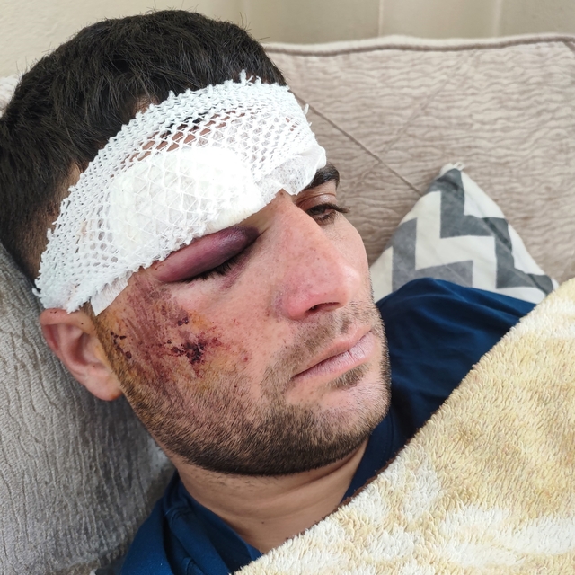 Döner ustası motosiklet sürücüsü: "Kaza sonrası kaçıp gittiler"
Sürücü, çar...