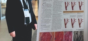 Türk kalp cerrahı Doç Dr. Yakut ve ekibinden uluslararası başarı