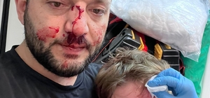 İkra ile babasının darbedilmesine ilişkin iddianame hazırlandı; çocuk skute...