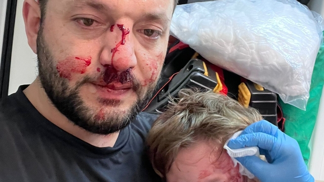 İkra ile babasının darbedilmesine ilişkin iddianame hazırlandı; çocuk skuter'ı 'silah' olarak sayıldı