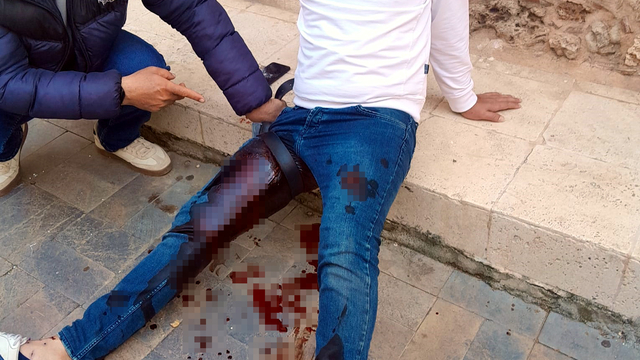 Tartıştığı butik sahibine pompalı tüfekle saldırdı: 3 yaralı