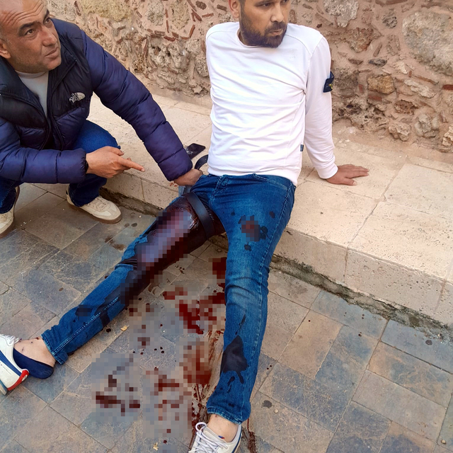 Tartıştığı butik sahibine pompalı tüfekle saldırdı: 3 yaralı