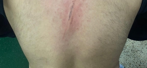 Maç öncesi ortalık karıştı: Futbolcular kramponlarla darbedildi