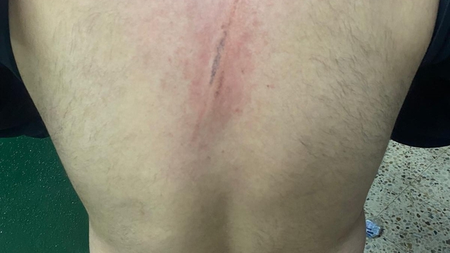 Maç öncesi ortalık karıştı: Futbolcular kramponlarla darbedildi