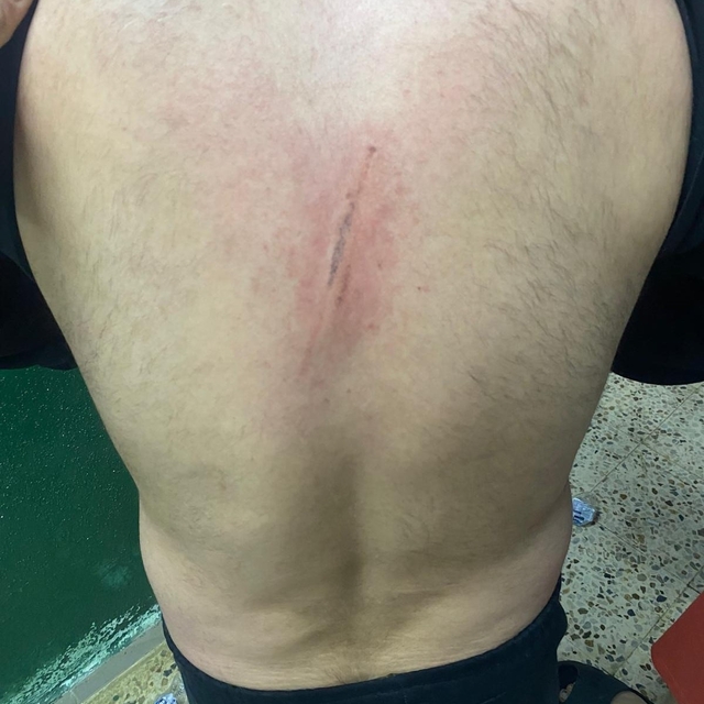 Maç öncesi ortalık karıştı: Futbolcular kramponlarla darbedildi