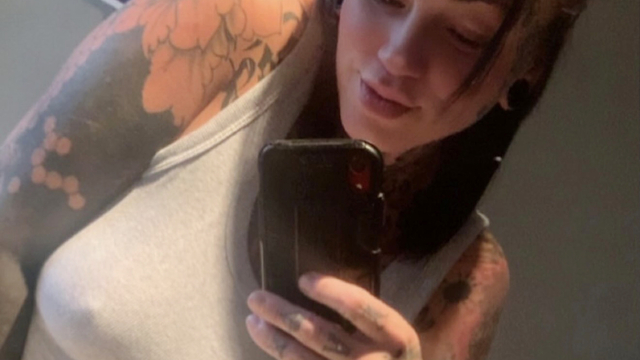 Göğüs ve karın gerdirme ameliyatına geldiği Antalya'da öldü