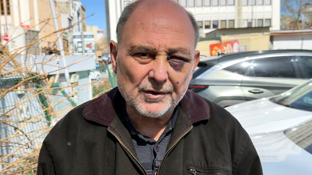 Annesinin cenazesinden dönüşte darbedildi: Çift görüyorum, iyi değilim, şikayetçiyim