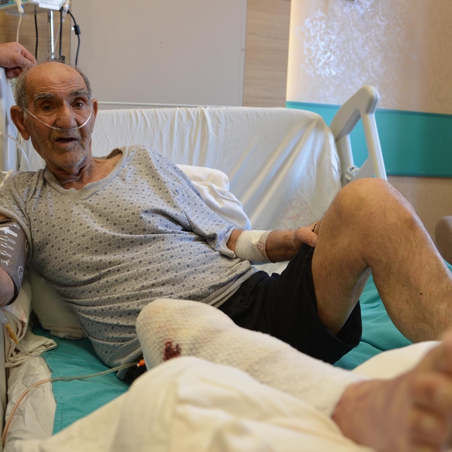 Tıkalı lavaboyu açmaya çalıştı, kimyasal yanıkla hastanelik oldu