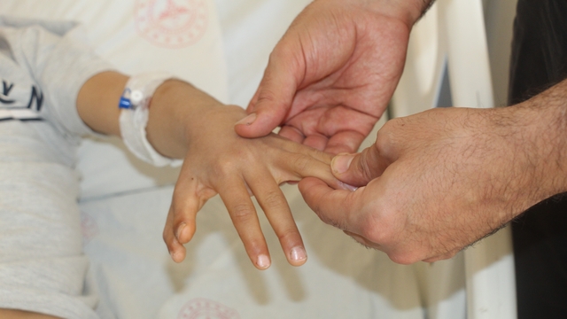 Şırnak'ta yapışık parmaklı iki kardeş ameliyatla sağlıklarına kavuştu