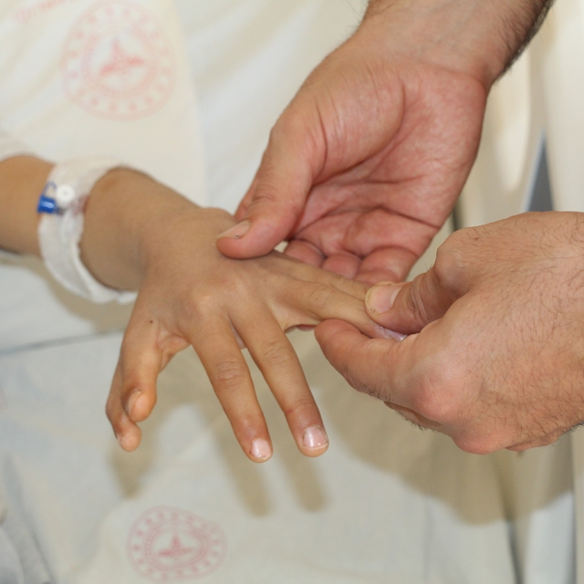 Şırnak'ta yapışık parmaklı iki kardeş ameliyatla sağlıklarına kavuştu