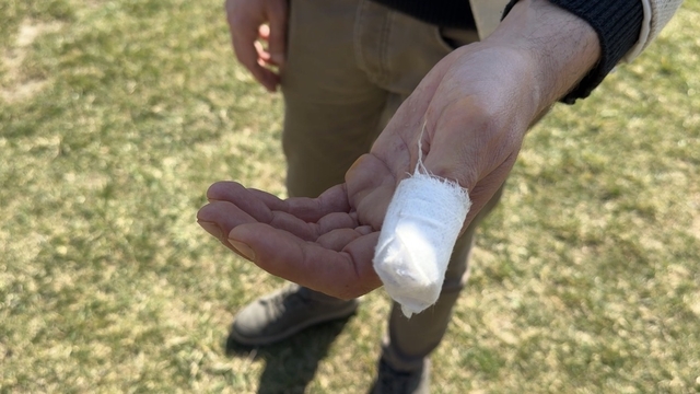 Parkta köpeği Şans ile gezerken başıboş pitbullun saldırısına uğradı